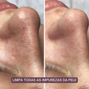 Limpador Facial 3 em 1 - Slap Skin